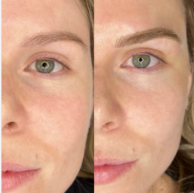 Microblading