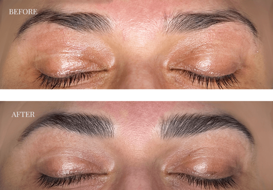 before-and-after-microblading
