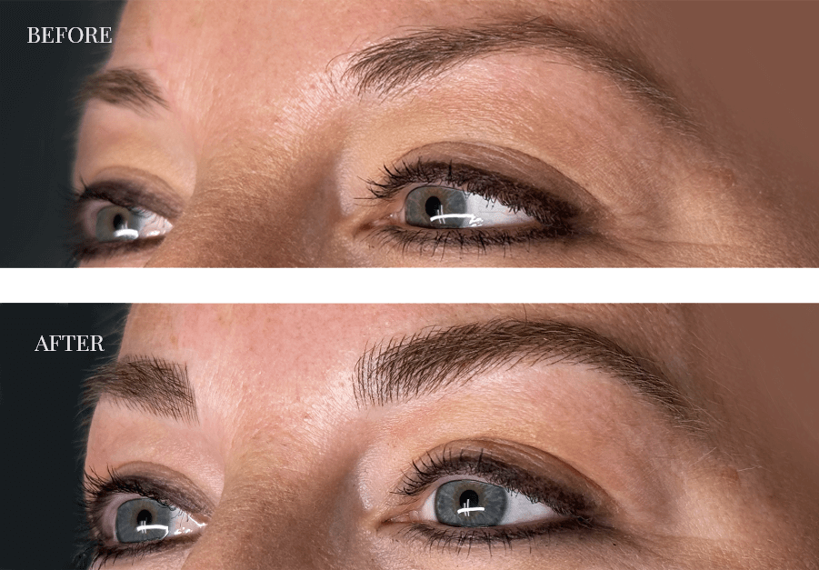 before-and-after-microblading