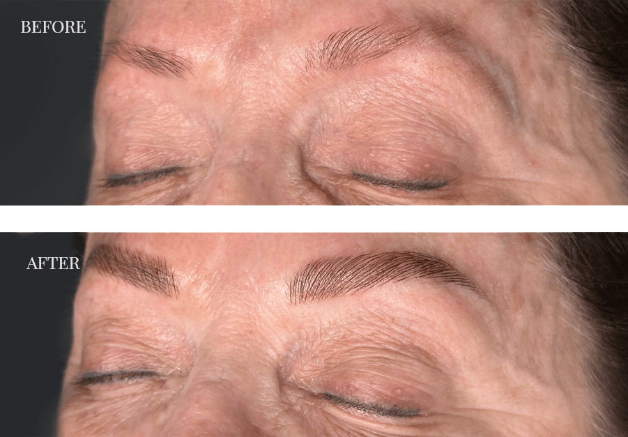 before-and-after-microblading
